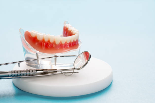 Full Mouth Reconstruction in Brown Station, MD