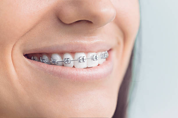 Why Choose Us for Your Dental Needs in Brown Station, MD